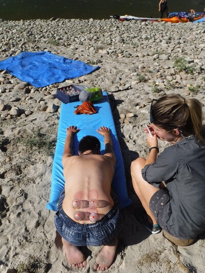 Cupping 